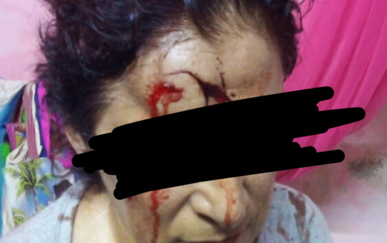 Atacan y amenazan de muerte a parte del equipo de campaña de candidato a la alcaldía