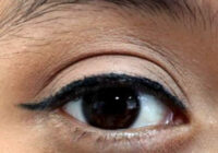 Informa IMSS Veracruz Sur sobre enfermedad de COATS y la importancia de cuidar a niños en edades tempranas