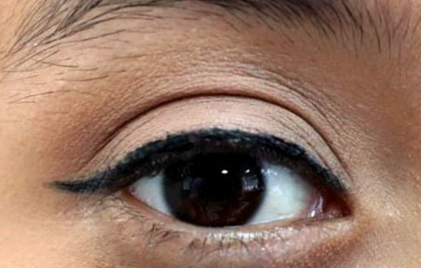 Informa IMSS Veracruz Sur sobre enfermedad de COATS y la importancia de cuidar a niños en edades tempranas