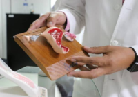 Ofrece IMSS Veracruz Sur tratamiento para cáncer de ovario