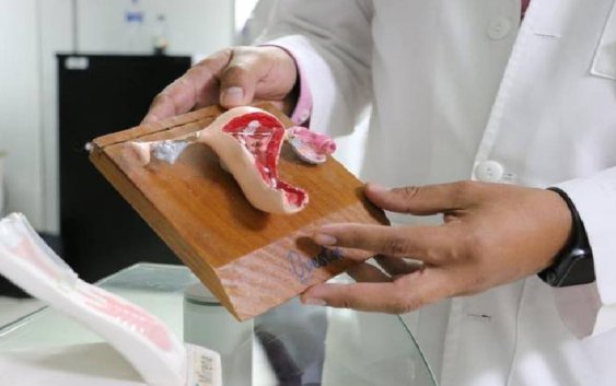 Ofrece IMSS Veracruz Sur tratamiento para cáncer de ovario