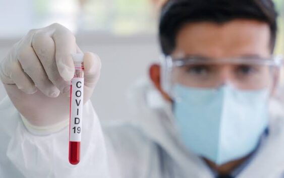 CONTABILIZA SALUD EDOMÉX 101, 904 ALTAS SANITARIAS DE MEXIQUENSES QUE SE RECUPERARON DE COVID-19