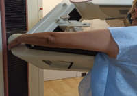 Invita IMSS Veracruz Sur a realizarse mastografías