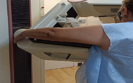 Invita IMSS Veracruz Sur a realizarse mastografías