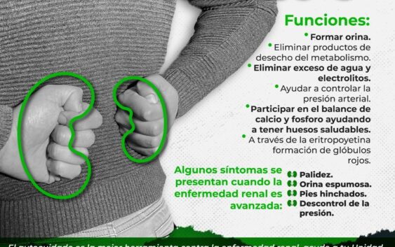 Ofrece IMSS Veracruz Sur reglas para cuidar el riñón
