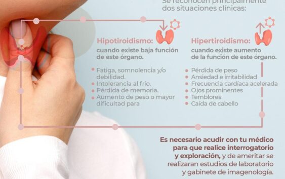 Problemas en glándula tiroidea puede ocasionar pérdida o aumento de peso: IMSS Veracruz Sur