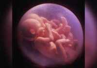 Inexistente embarazo múltiple de mujer de #Ixtapaluca; decían que eran 13 niñas