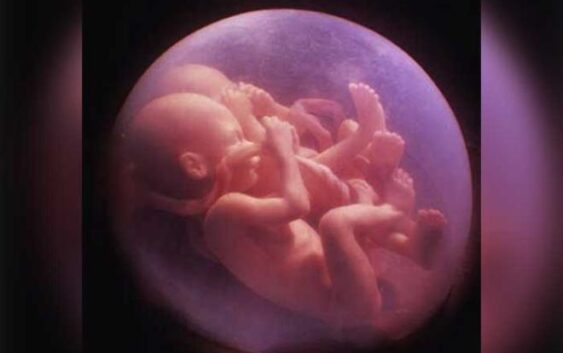 Inexistente embarazo múltiple de mujer de #Ixtapaluca; decían que eran 13 niñas