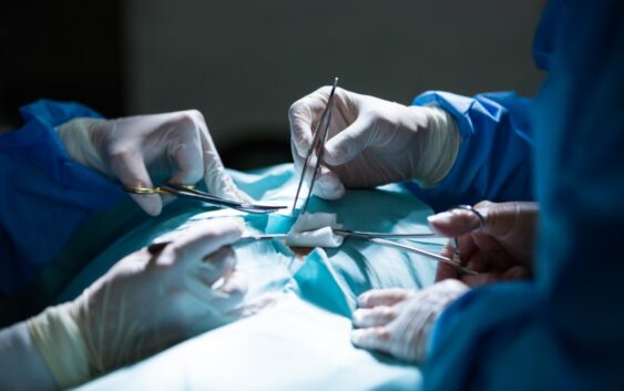 Recomendaciones de IMSS Veracruz Sur para evitar hernias