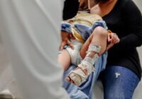 Con injerto de piel cultivada, IMSS Chiapas ayuda a recuperación de pacientes quemados