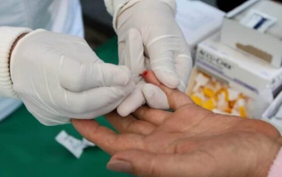 Informa IMSS Veracruz Sur sobre sintomatología hepatitis C