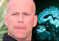 Bruce Willis es diagnosticado con demencia frontotemporal: ¿Qué es y cuáles son sus síntomas?