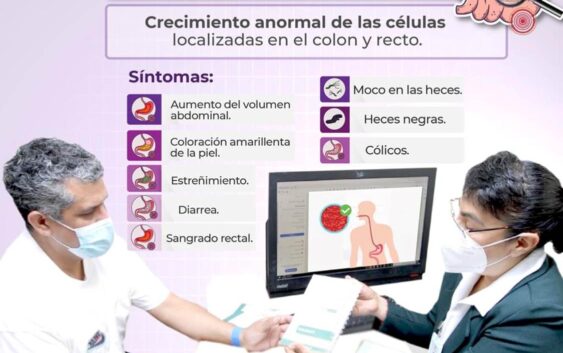 Advierte IMSS Veracruz Sur sobre cáncer de colon