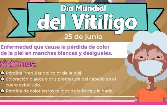 Explica IMSS Veracruz Sur sobre vitíligo