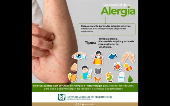 Explica IMSS Veracruz Sur síntomas de alergias
