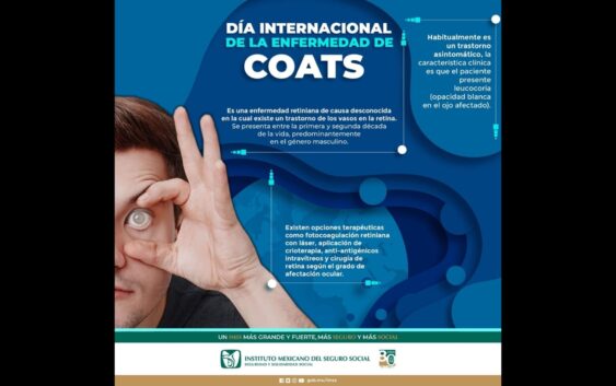 Informa IMSS Veracruz Sur sobre enfermedad de Coats