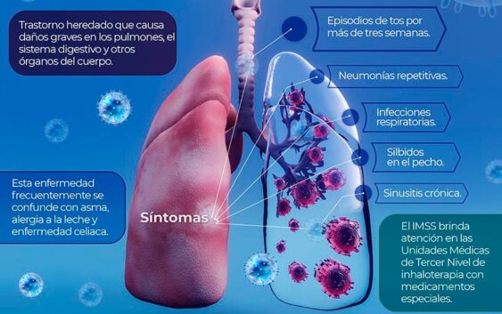 Recomienda IMSS Veracruz Sur realizar Tamiz Metabólico Neonatal a recién nacido para detectar Fibrosis Quística
