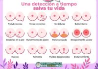 Recomienda IMSS Veracruz Sur autoexploración, herramienta para prevenir cáncer de mama