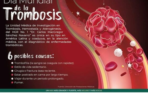 Explica IMSS Veracruz Sur sobre síntomas de trombosis 