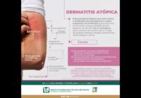 Informa IMSS Veracruz Sur sobre síntomas de dermatitis atópica
