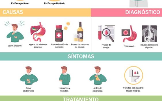 Explica IMSS Veracruz Sur sobre síntomas de gastritis