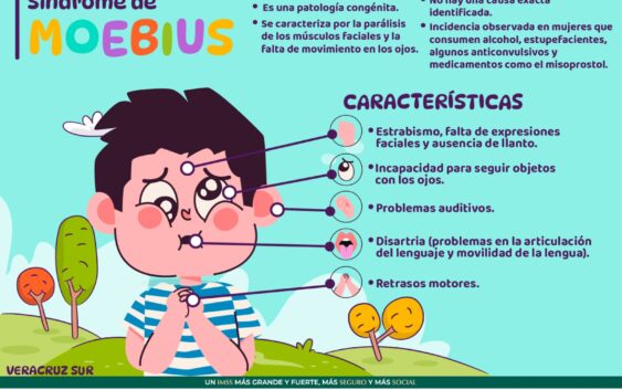 Informa IMSS Veracruz Sur sobre síndrome de Moebius