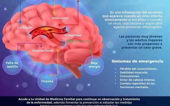Orienta IMSS Veracruz Sur sobre síntomas y causas de encefalitis