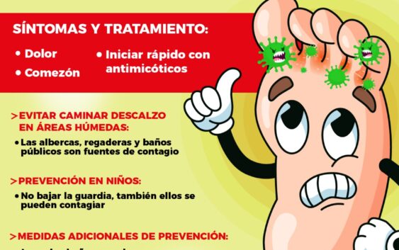 Pide IMSS Veracruz Sur prevenir pie de atleta