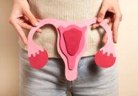 Exhorta IMSS Veracruz Sur a atenderlos “cólicos” menstruales
