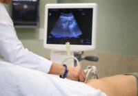 Informa IMSS Veracruz Sur sobreSíndrome de Ovario Poliquístico