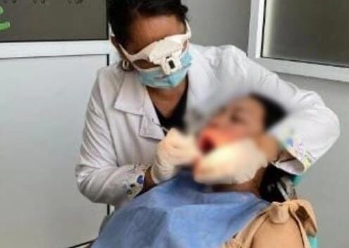 Realiza IMSS Veracruz Sur Primera Feria de Salud Bucal 2025