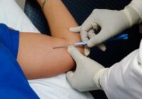 Realizará IMSS Veracruz Sur jornada de colocación de implantes subdérmicos