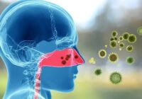 Invita IMSS Veracruz Sur a informarse para prevenir y tratar enfermedades alérgicas