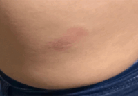 Policía municipal golpea a pareja de motociclistas en Soledad de Doblado