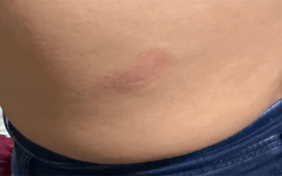 Policía municipal golpea a pareja de motociclistas en Soledad de Doblado