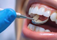 Recomienda IMSS Veracruz Sur cuidar salud bucal