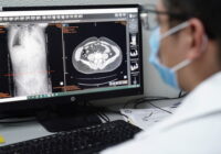 Impulsa IMSS Veracruz Sur prevención y detección oportuna de EPOC