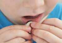 Exhorta IMSS Veracruz Sur a padres de familia a prevenir accidentes por ingesta de objetos en niñas y niños