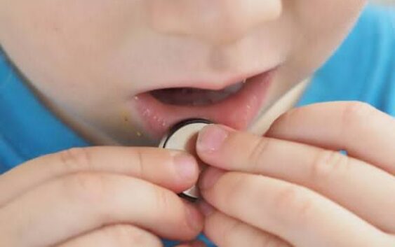 Exhorta IMSS Veracruz Sur a padres de familia a prevenir accidentes por ingesta de objetos en niñas y niños