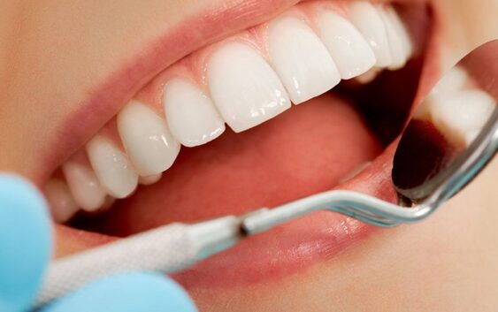 Exhorta IMSS Veracruz Sur reforzar salud bucodental