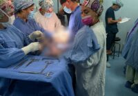 Recibió Hospital General Regional No. 1 del IMSS Veracruz Sur, segundo parto trigemelar