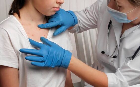 Día mundial contra la lepra: DIF Coatzacoalcos