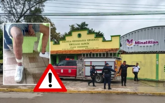 Perros pitbulls atacan a estudiantes en secundaria de Minatitlán; hay 7 lesionados
