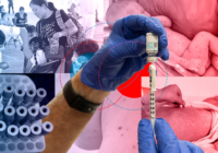 México cerró 2025 con el mayor brote de sarampión