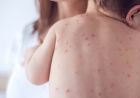 No vacunado: decisiones y omisiones de Estado que cobran vidas humanas