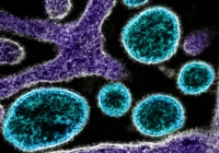 Virus Nipah: qué es, cómo se transmite y dónde se están produciendo los brotes