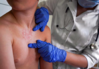 Un contagio por hora: la epidemia de sarampión que México no pudo frenar