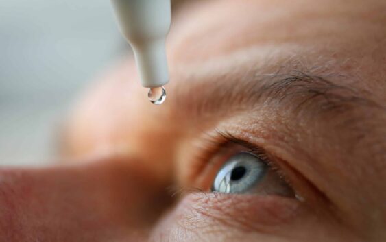 Llama IMSS Veracruz Sur a detección oportuna de glaucoma