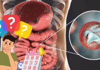 Emite IMSS Veracruz Sur recomendaciones para prevenir enfermedades gastrointestinales