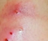 Confirman la primera muerte por miasis humana en esta entidad. Estos son los síntomas